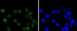 CHK2 Antibody in Immunocytochemistry (ICC/IF)
