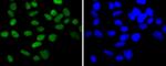 CHK2 Antibody in Immunocytochemistry (ICC/IF)