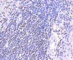 CHK2 Antibody in Immunohistochemistry (Paraffin) (IHC (P))