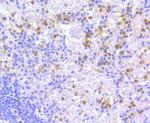 ATG7 Antibody in Immunohistochemistry (Paraffin) (IHC (P))