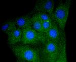 Myoglobin Recombinant Rabbit Monoclonal Antibody (SC06-38)