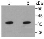 Annexin A10 Recombinant Rabbit Monoclonal Antibody (SC06-02)