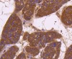 CD13 Recombinant Rabbit Monoclonal Antibody (SC70-01)