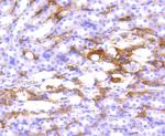 HLA-DR Antibody in Immunohistochemistry (Paraffin) (IHC (P))