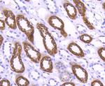 WAVE2 Antibody in Immunohistochemistry (Paraffin) (IHC (P))