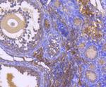 DIABLO Antibody in Immunohistochemistry (Paraffin) (IHC (P))