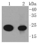 AKAP14 Recombinant Rabbit Monoclonal Antibody (SC0667)