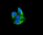 Ferritin Antibody in Immunocytochemistry (ICC/IF)
