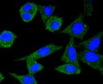 Ferritin Recombinant Rabbit Monoclonal Antibody (SC0620)