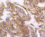 Cortactin Antibody in Immunohistochemistry (Paraffin) (IHC (P))