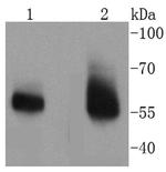 IRAK-M Recombinant Rabbit Monoclonal Antibody (SN64-07)