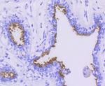 MUC1 Antibody in Immunohistochemistry (Paraffin) (IHC (P))