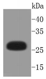 Phospho-HSP27 (Ser82) Recombinant Rabbit Monoclonal Antibody (SN06-73)