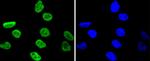 Phospho-MSK1 (Ser376) Recombinant Rabbit Monoclonal Antibody (SN63-05)