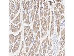 Phospho-HSL (Ser853) Recombinant Rabbit Monoclonal Antibody (SN06-39)