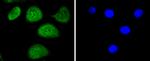 Phospho-c-Myc (Thr58) Recombinant Rabbit Monoclonal Antibody (SN60-01)