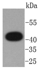 CXCR7 Recombinant Rabbit Monoclonal Antibody (SN65-09)