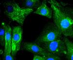AGR2 Recombinant Rabbit Monoclonal Antibody (SN74-01)