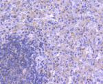 ATG5 Antibody in Immunohistochemistry (Paraffin) (IHC (P))