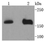 NSD3 Recombinant Rabbit Monoclonal Antibody (SN07-11)