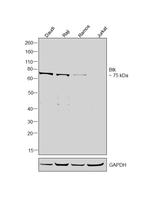 Btk Antibody in Western Blot (WB)