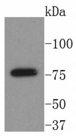 Btk Antibody in Western Blot (WB)