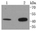AGTR2 Recombinant Rabbit Monoclonal Antibody (SN71-03)