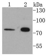 Cytokeratin 1 Antibody in Western Blot (WB)