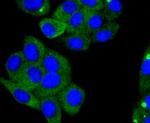 ACE2 Recombinant Rabbit Monoclonal Antibody (SN0754)