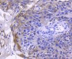 ACE2 Recombinant Rabbit Monoclonal Antibody (SN0754)