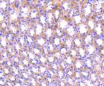 ABCF1 Antibody in Immunohistochemistry (Paraffin) (IHC (P))