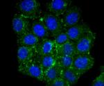 CPT2 Recombinant Rabbit Monoclonal Antibody (SN06-70)