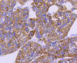 CPT2 Antibody in Immunohistochemistry (Paraffin) (IHC (P))