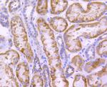 CPT2 Antibody in Immunohistochemistry (Paraffin) (IHC (P))