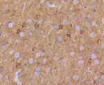 KV1.1 (KCNA1) Recombinant Rabbit Monoclonal Antibody (SN66-06)