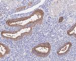CA125 Antibody in Immunohistochemistry (Paraffin) (IHC (P))