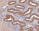 CA125 Antibody in Immunohistochemistry (Paraffin) (IHC (P))