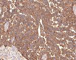 CA125 Antibody in Immunohistochemistry (Paraffin) (IHC (P))
