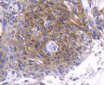 Phospho-PKC zeta (Thr560) Recombinant Rabbit Monoclonal Antibody (SN0753)