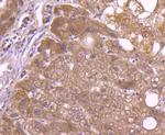 CD81 Antibody in Immunohistochemistry (Paraffin) (IHC (P))