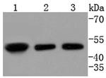 E2F2 Recombinant Rabbit Monoclonal Antibody (SN201-04)