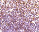LSP1 Antibody in Immunohistochemistry (Paraffin) (IHC (P))