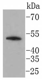 LSP1 Antibody in Western Blot (WB)