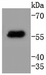 Cytokeratin 4 Antibody in Western Blot (WB)