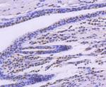 SMC1 Antibody in Immunohistochemistry (Paraffin) (IHC (P))
