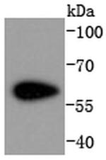 CDK8 Recombinant Rabbit Monoclonal Antibody (SN2030)