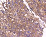 ARF1 Recombinant Rabbit Monoclonal Antibody (SD2002)
