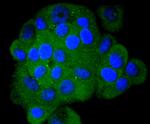 S100A4 Antibody in Immunocytochemistry (ICC/IF)