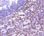 S100A4 Antibody in Immunohistochemistry (Paraffin) (IHC (P))