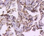 S100A4 Antibody in Immunohistochemistry (Paraffin) (IHC (P))